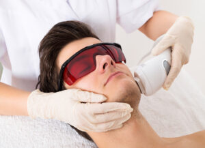 CO2 Laser Facial Resurfacing