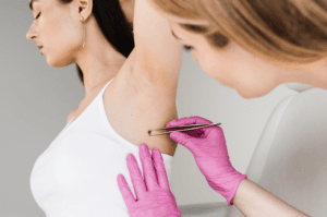 Skin Lesion Removal: When to See a Plastic Surgeo