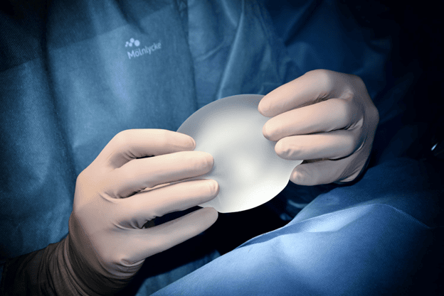 Breast Augmentation vs Implants: What You Need to Know